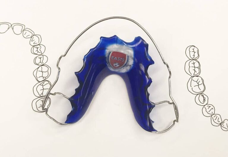 What is an Orthodontic Plate - Martin Fine